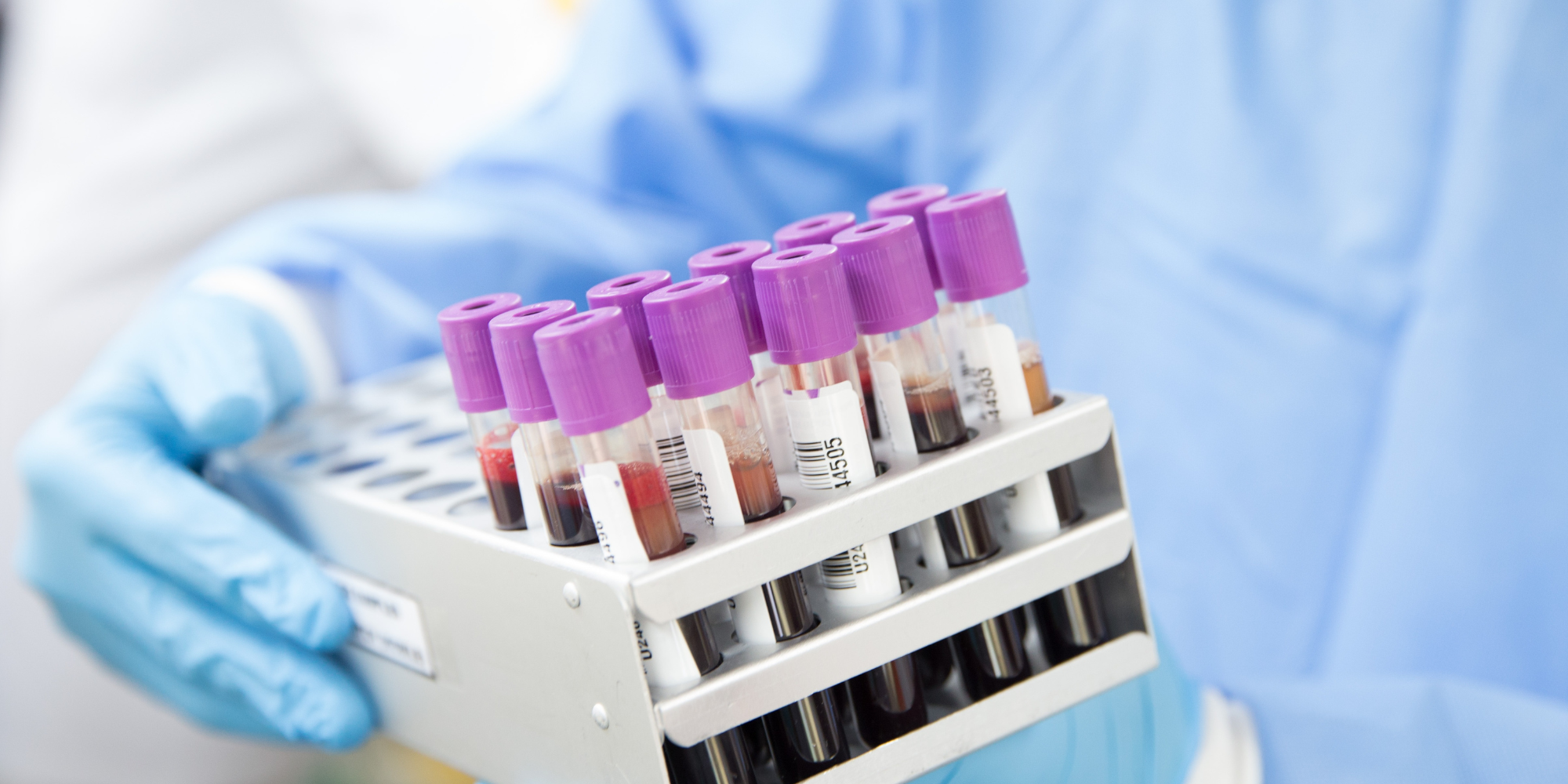 Blood Sampling